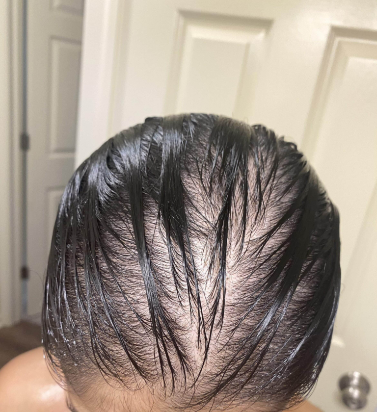 Signs of Hair Shedding vs Hair Loss: How to Tell What’s Really Going On With Your Hair