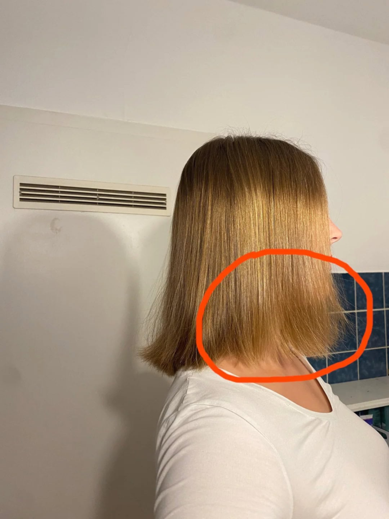 How to Fix Damaged Thin Hair: Simple Treatments That Actually Work