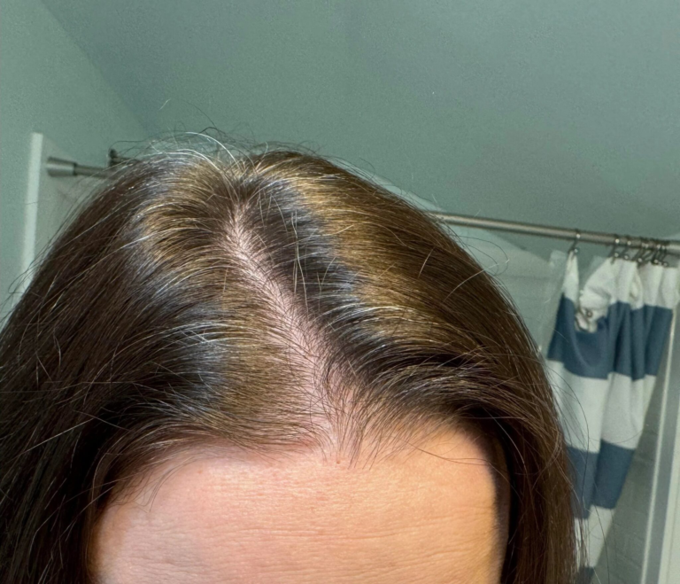 8 Vitamins for Thinning Hair for Women: What Really Works and Why It Matters