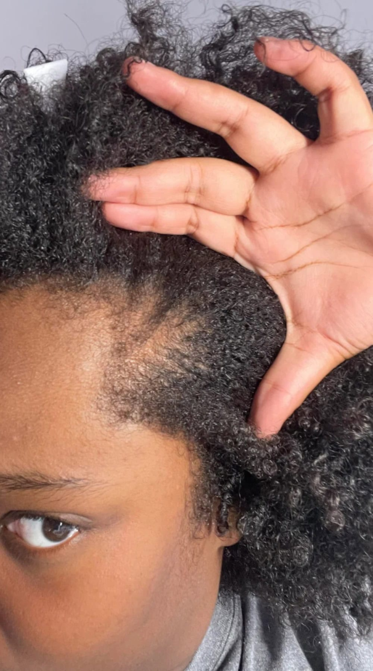 How to Grow Edges Back Fast: Tried and Tested Tips for a Fuller Hairline