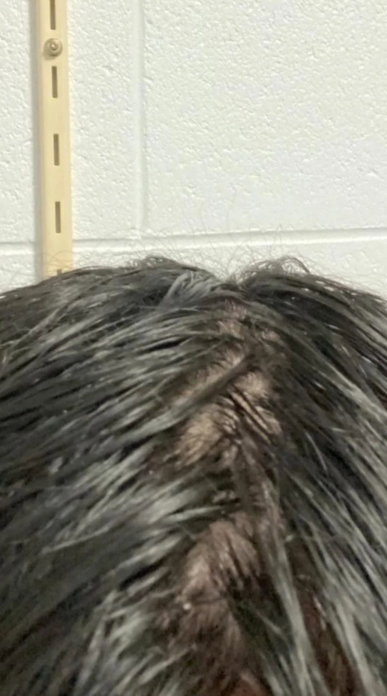 Why Is My Hair Shedding More Than Usual? Uncover the Causes and Solutions